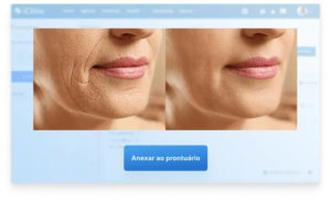 Print de tela do prontuário eletrônico Afya iClinic mostrando fotos adicionadas