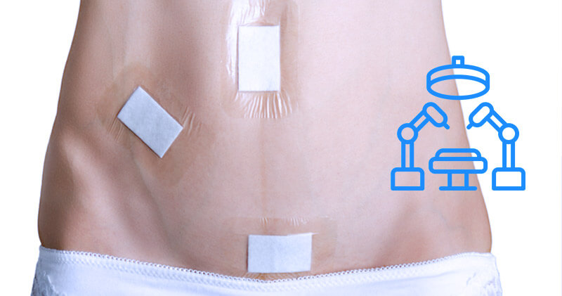 cirurgia robotica curativos na barriga