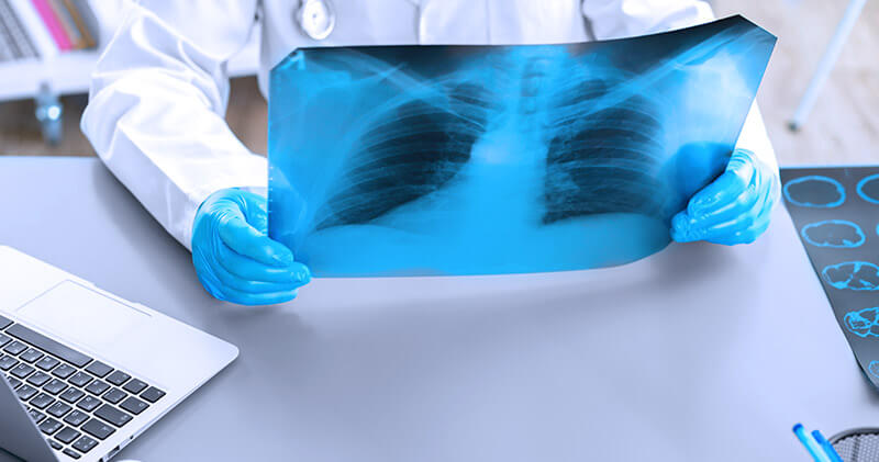 Conheça a telerradiologia e 5 serviços úteis da Telemedicina! 6 telerradiologia raio x do pulmao