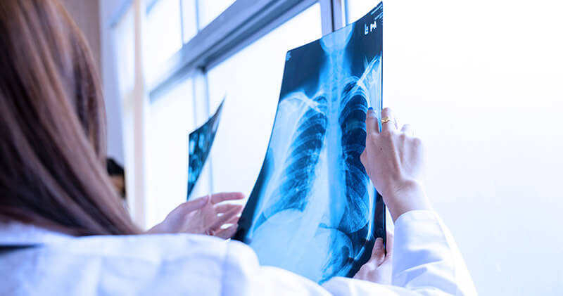 Conheça a telerradiologia e 5 serviços úteis da Telemedicina! 3 telerradiologia raio x pulmonar