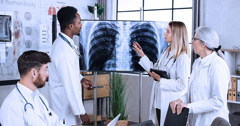 conhecimento na area da saude raio x de pulmao