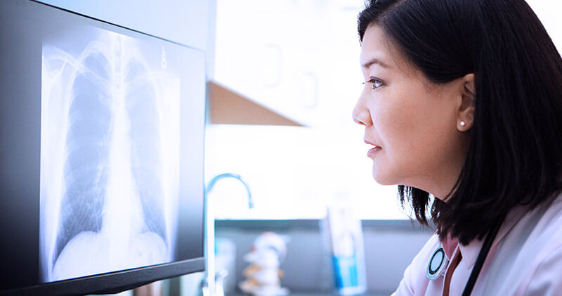 O que diz a lei para entrega de exames médicos? 3 lei para entrega de exames raio x pulmoes