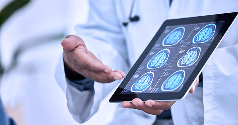 informatica medica raio x cerebral