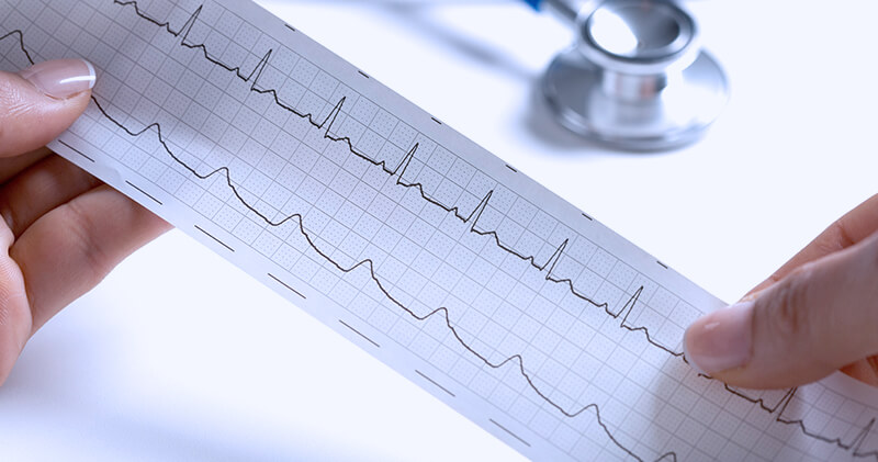 Conheça os principais benefícios do serviço home care e se vale a pena implementá-lo! 10 home care graficos